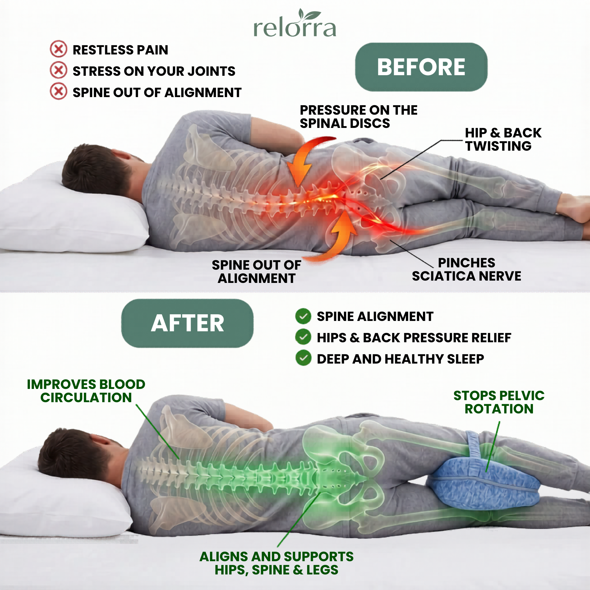 Diagram showing how proper knee alignment stops pelvic rotation during side sleeping